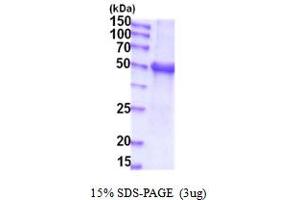 SDS-PAGE (SDS) image for UDP Glucuronosyltransferase 1 Family, Polypeptide A1 (UGT1A1) (AA 26-490) protein (His tag) (ABIN5854140)
