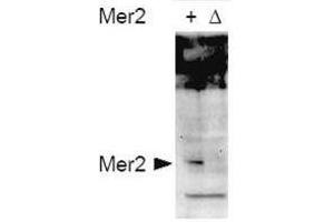 Western blot using  affinity purified anti-S. (CD151 anticorps  (pSer30))