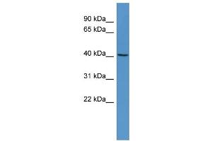 WB Suggested Anti-RASSF6 Antibody Titration: 0. (RASSF6 anticorps  (Middle Region))