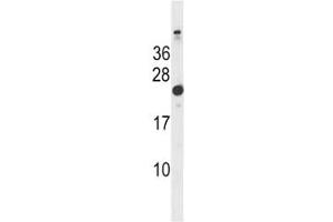 Hras1 antibody western blot analysis in mouse bladder tissue lysate.