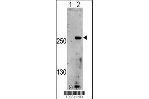 Western blot analysis of PIP5K3 using rabbit polyclonal PIP5K3 Antibody using 293 cell lysates (2 ug/lane) either nontransfected (Lane 1) or transiently transfected with the PIP5K3 gene (Lane 2).