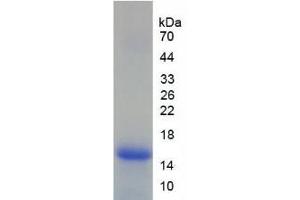 SDS-PAGE analysis of Human Lymphocyte Antigen 96 Protein. (LY96 Protéine)