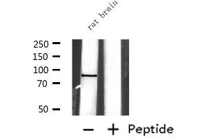 Western blot analysis of extracts from rat brain, using EXT1 Antibody.