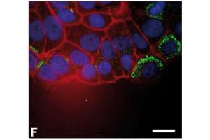 Immunofluorescence image of Thymosin beta10 staining of MCF7 cells in a wound/scratch assay. (Thymosin beta 10 anticorps  (AA 1-14))