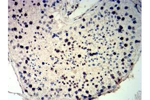 Immunohistochemical analysis of paraffin-embedded testis tissues using CDKN1C mouse mAb with DAB staining.