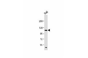 Anti-PI3KCD Antibody (C-term) at 1:2000 dilution + Raji whole cell lysate Lysates/proteins at 20 μg per lane.