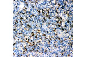 IHC(P): Human Tonsil Tissue