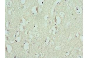 Immunohistochemistry of paraffin-embedded human brain tissue using ABIN7151371 at dilution of 1:100