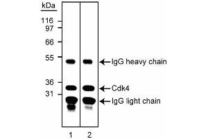 Immunoprecipitiation/western blot analysis of Cdk4. (CDK4 anticorps)