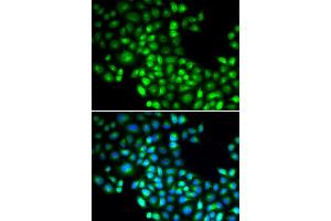 Immunofluorescence analysis of U20S cell using FOXP1 antibody. (FOXP1 anticorps)