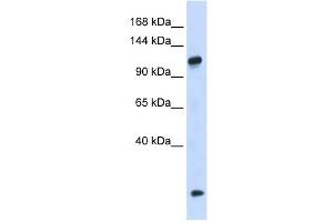 HEATR4 antibody used at 1 ug/ml to detect target protein. (HEATR4 anticorps  (N-Term))