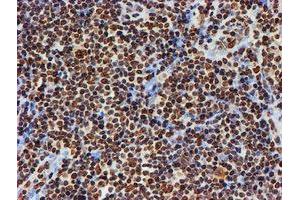 Image no. 2 for anti-Fragile X Mental Retardation 1 (FMR1) antibody (ABIN1498287)