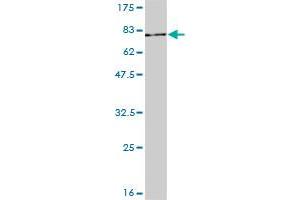 STAT3 monoclonal antibody (M01), clone 1D11-2A11.