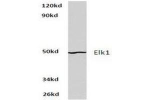 Image no. 1 for anti-ELK1, Member of ETS Oncogene Family (ELK1) antibody (ABIN265398) (ELK1 anticorps)
