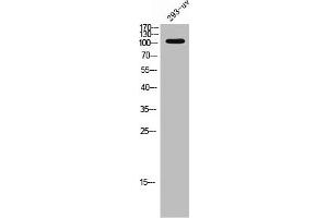 Western Blot analysis of 293T-UV cells using EphA3 Polyclonal Antibody (EPH Receptor A3 anticorps  (C-Term))