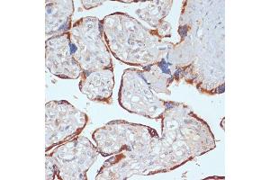 Immunohistochemistry of paraffin-embedded human placenta using PDGFRB antibody (ABIN3023138, ABIN3023139, ABIN3023140 and ABIN6219408) at dilution of 1:100 (40x lens). (PDGFRB anticorps  (AA 887-1106))
