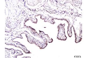 Paraformaldehyde-fixed, paraffin embedded rat bladder, Antigen retrieval by boiling in sodium citrate buffer (pH6) for 15min, Block endogenous peroxidase by 3% hydrogen peroxide for 30 minutes, Blocking buffer (normal goat serum) at 37°C for 20min, Antibody incubation with Syndecan 1 Polyclonal Antibody, Unconjugated  at 1:400 overnight at 4°C, followed by a conjugated secondary and for 20 minutes and DAB staining. (Syndecan 1 anticorps  (AA 201-310))