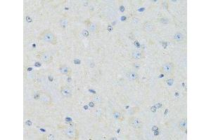 Immunohistochemistry of paraffin-embedded Mouse brain using SLC22A5 Polyclonal Antibody at dilution of 1:100 (40x lens). (SLC22A5 anticorps)