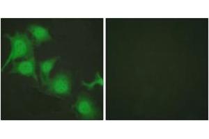 Immunofluorescence analysis of HuvEc cells, using Nrf2 Antibody. (NRF2 anticorps  (AA 556-605))