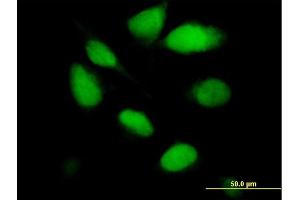 Immunofluorescence of purified MaxPab antibody to UNG on HeLa cell. (UNG anticorps  (AA 1-304))