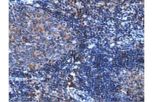 Immunohistochemistry (IHC) image for anti-rho GTPase Activating Protein 25 (ARHGAP25) antibody (ABIN1496706) (ARHGAP25 anticorps)