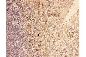 IHC-P: CXCR3 antibody testing of human tonsil tissue (CXCR3 anticorps  (AA 1-368))