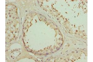 Immunohistochemistry of paraffin-embedded human testis tissue using ABIN7150657 at dilution of 1:100 (DSCR9 anticorps  (AA 1-149))