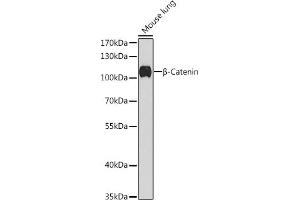 Western blot analysis of extracts of Mouse lung, using β-Catenin antibody (ABIN1684202, ABIN1512789, ABIN3020926 and ABIN3020928) at 1:1000 dilution. (CTNNB1 anticorps)
