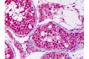 Anti-UBA6 antibody IHC of human testis.