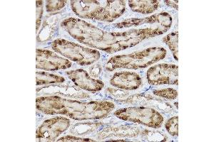 Immunohistochemistry of paraffin-embedded rat kidney using  Rabbit mAb (ABIN7265552) at dilution of 1:100 (40x lens).