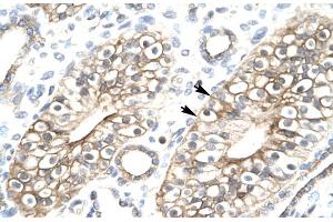 Human kidney (FLJ11730 (N-Term) anticorps)