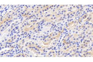 Detection of LEP in Human Kidney Tissue using Polyclonal Antibody to Leptin (LEP)