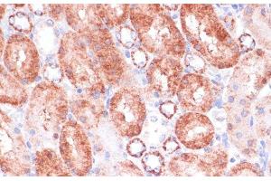 Immunohistochemistry of paraffin-embedded Rat kidney using VASP Polyclonal Antibody at dilution of 1:100 (40x lens).