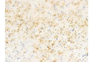 anti-Heat Shock 70kDa Protein 14 (HSPA14) antibody