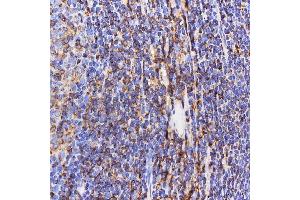 IHC analysis of SEPT6/SEPTIN6 using anti-SEPT6/SEPTIN6 antibody (ABIN7599390). (Septin 6 anticorps  (AA 1-434))