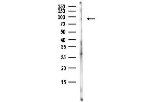 Western blot analysis of lysates from HepG2 cells(starvation, 24h treatment), using MCM3 Antibody at 1/1000 dilution.