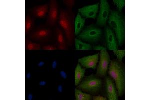 ABIN6264433 and ABIN6276469 staining  cells by IF/ICC.