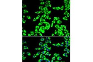 Immunofluorescence analysis of MCF7 cells using RPL14 Polyclonal Antibody (RPL14 anticorps)