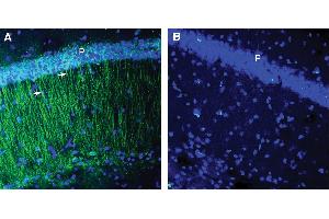 Expression of CCR2 in mouse hippocampus. (CCR2 anticorps  (Extracellular))
