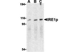 Western Blotting (WB) image for anti-Endoplasmic Reticulum To Nucleus Signaling 1 (ERN1) (C-Term) antibody (ABIN1030448) (ERN1 anticorps  (C-Term))