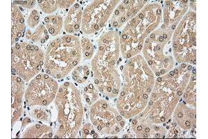 Immunohistochemical staining of paraffin-embedded pancreas tissue using anti-TYRO3mouse monoclonal antibody. (TYRO3 anticorps)