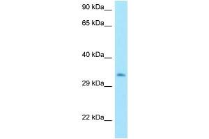 WB Suggested Anti-MTX3 Antibody Titration: 1. (MTX3 anticorps  (C-Term))