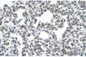 Human Lung (TMPRSS11D anticorps  (N-Term))