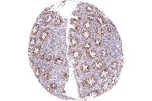 Appendix mucosa showing a strong granular cytoplasmic SDHA positivity of all epithelial cells while staining is weak to moderate in lymphocytes (Recombinant SDHA anticorps  (N-Term))