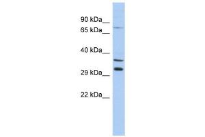 TSGA13 antibody used at 1 ug/ml to detect target protein. (TSGA13 anticorps  (Middle Region))