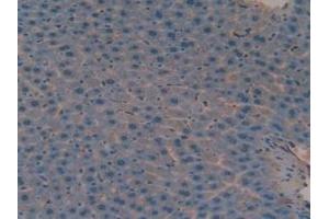 Detection of VCAN in Mouse Liver Tissue using Polyclonal Antibody to Versican (VCAN)