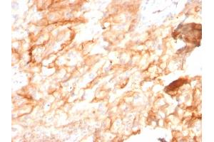 Formalin-fixed, paraffin-embedded human Kidney stained with CD10 Mouse Monoclonal Antibody (MME/2590). (MME anticorps  (AA 297-483))