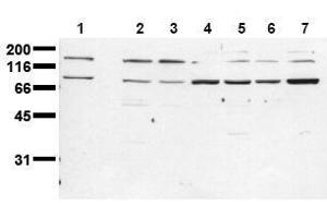 Western Blotting (WB) image for anti-Insulin Receptor (INSR) (Beta Chain) antibody (ABIN126820) (Insulin Receptor anticorps  (Beta Chain))