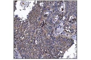 IHC analysis of DLGAP1 using anti-DLGAP1 antibody (ABIN7600257). (DLGAP1 anticorps  (AA 17-319))