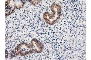 Image no. 3 for anti-Catenin (Cadherin-Associated Protein), beta 1, 88kDa (CTNNB1) antibody (ABIN1496889)